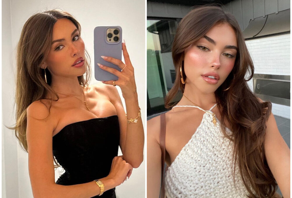 Madison Beer akne problemi s kožom