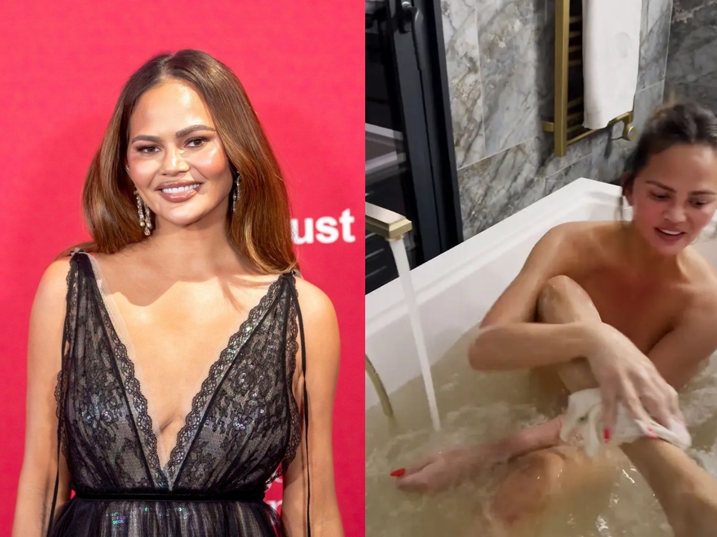 chrissy teigen