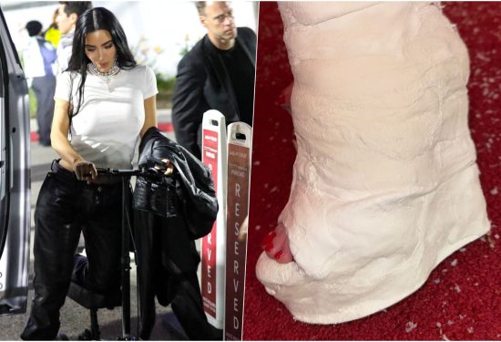 Kim Kardashian s ozlijeđenom nogom