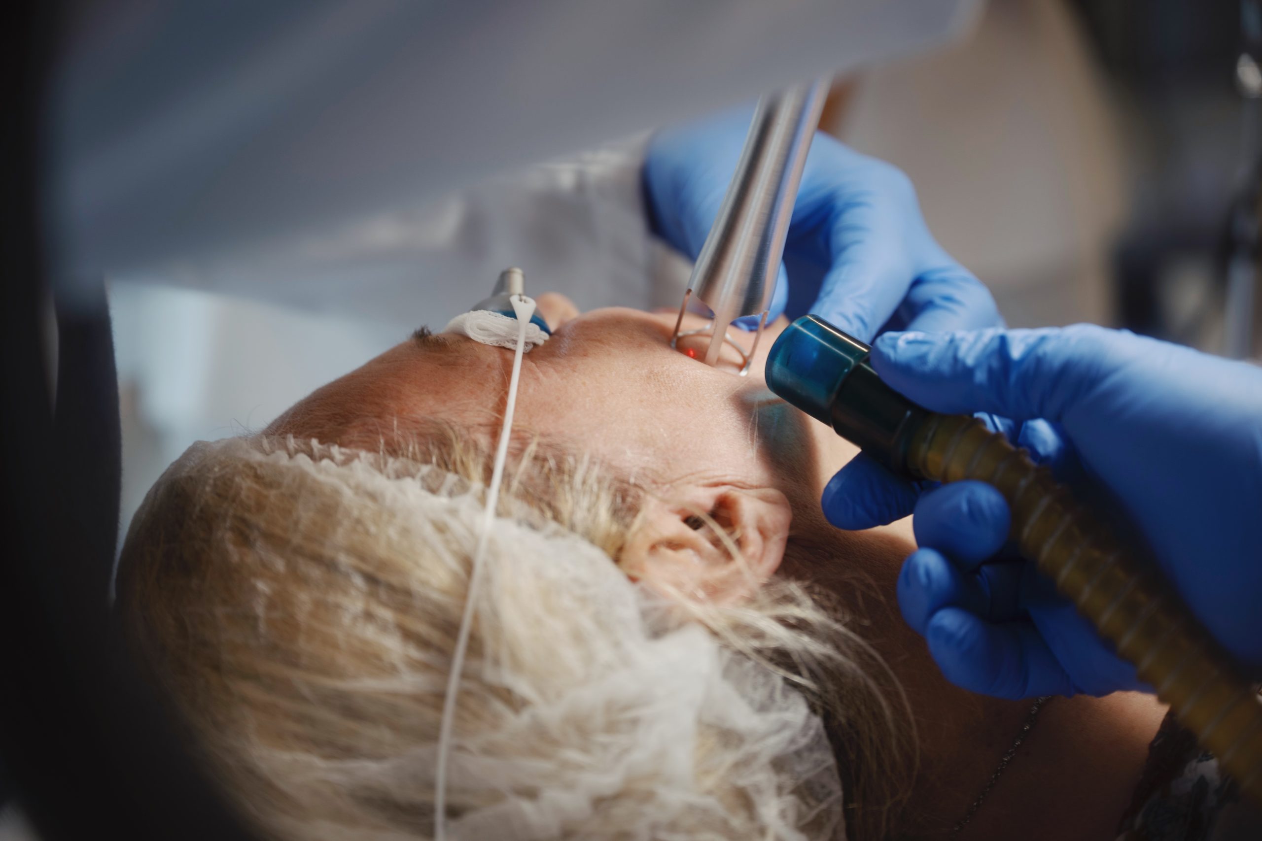 Pomlađivanje budućnosti stiglo je u regiju – UltraClear™ 2910 nm fiber laser ekskluzivno u Poliklinici Milojević!