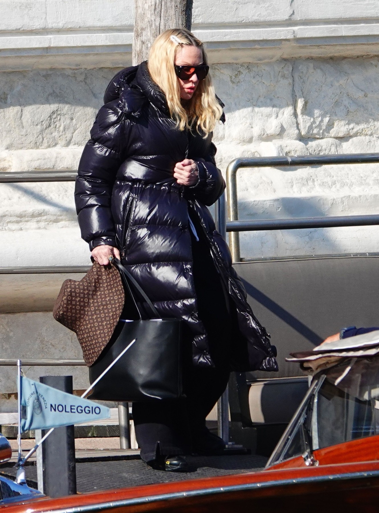 Madonna privukla pažnju detaljem na licu