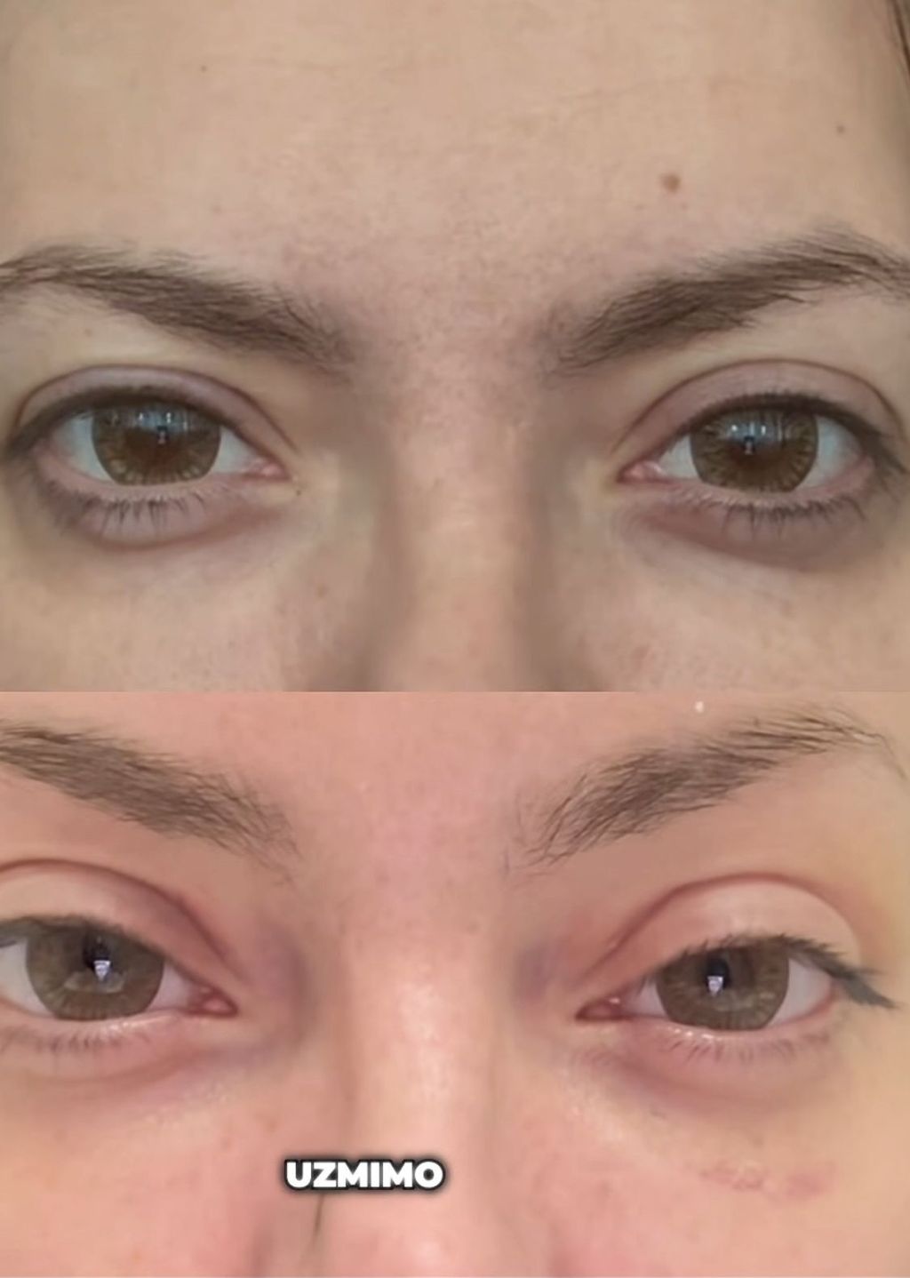 Ella Dvornik otvoreno o estetskim zahvatima HELLO MAGAZIN CROATIA HRVATSKA 67