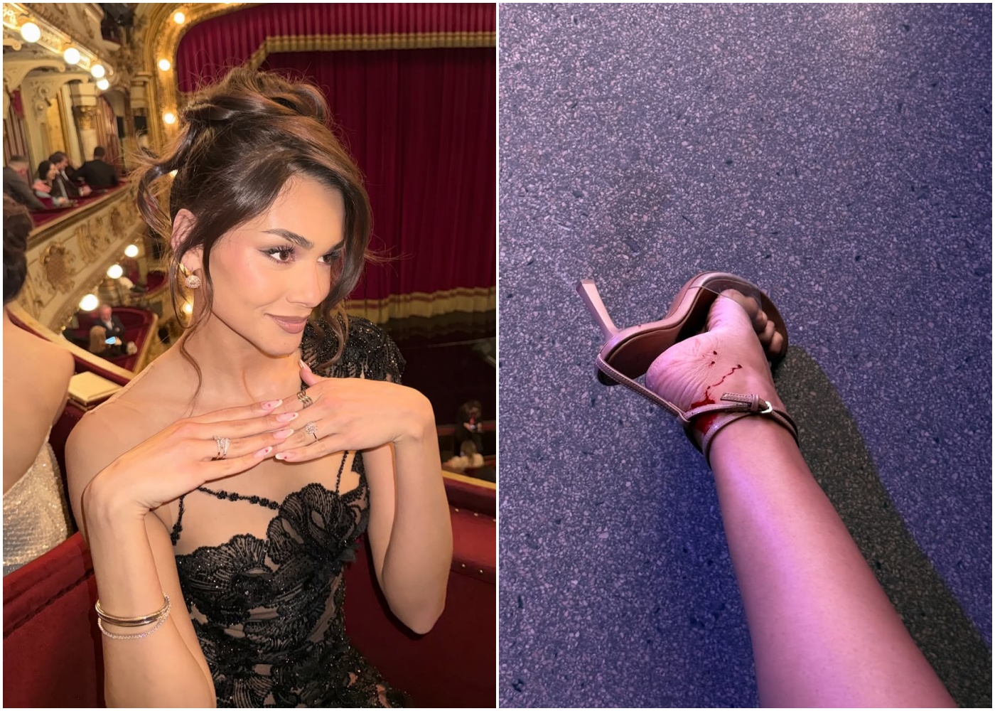 Laura Gnjatović pokazala realnost iza glamura