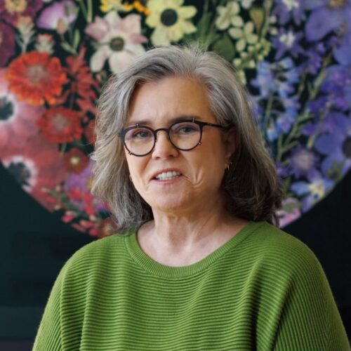 Rosie O'Donnell priznala da je bila na liftingu