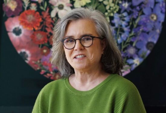 Rosie O'Donnell priznala da je bila na liftingu