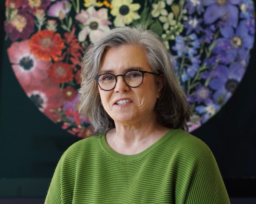 Rosie O'Donnell priznala da je bila na liftingu